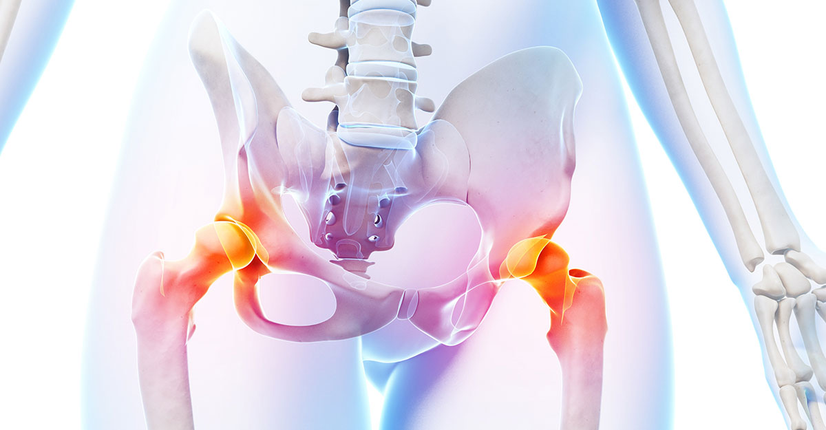 Groin pain