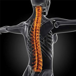 Herniated Disc, Oakleigh, VIC Chiropractor